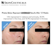 Load image into Gallery viewer, METACELL RENEWAL B3 / SKINCEUTICALS @ PEBBLE