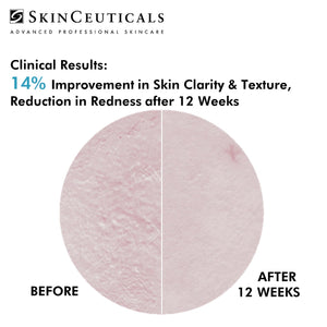 METACELL RENEWAL B3 / SKINCEUTICALS @ PEBBLE