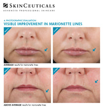 Load image into Gallery viewer, SKINCEUTICALS HA INTENSIFIER AT PEBBLE AESTHETIC