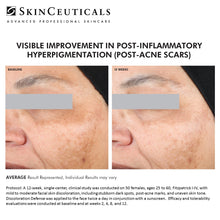 Load image into Gallery viewer, SKINCEUTICALS DISCOLORATION DEFENSE AT PEBBLE AESTHETIC