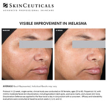 Load image into Gallery viewer, SKINCEUTICALS DISCOLORATION DEFENSE AT PEBBLE AESTHETIC