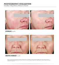 Load image into Gallery viewer, PHYTO CORRECTIVE ESSENCE MIST / SKINCEUTICALS @ PEBBLE *15% DIRECT DISCOUNT* Promotion