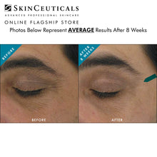 Load image into Gallery viewer, AOX + EYE GEL /  15% DIRECT DISCOUNT / SKINCEUTICALS @ PEBBLE

