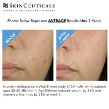 Load image into Gallery viewer, SKINCEUTICALS BLEMISH + AGE DEFENSE AT PEBBLE AESTHETIC
