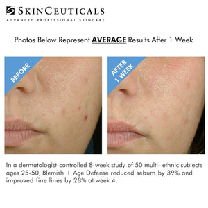 BLEMISH & AGE DEFENSE SERUM / SKINCEUTICALS @ PEBBLE *15% DIRECT DISCOUNT*