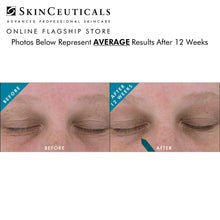 Load image into Gallery viewer, AOX + EYE GEL /  15% DIRECT DISCOUNT / SKINCEUTICALS @ PEBBLE
