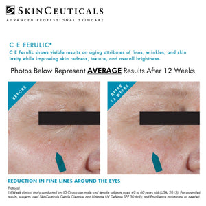 SKINCEUTICALS CE FERULIC @ PEBBLE AESTHETIC