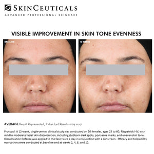 SKINCEUTICALS DISCOLORATION DEFENSE AT PEBBLE AESTHETIC